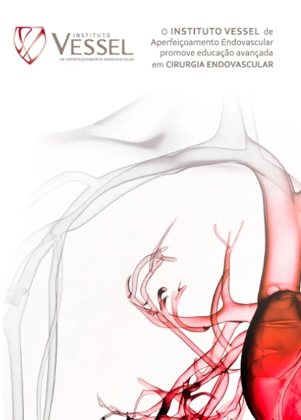 Fellowship de Cirurgia Endovascular do Instituto Vessel